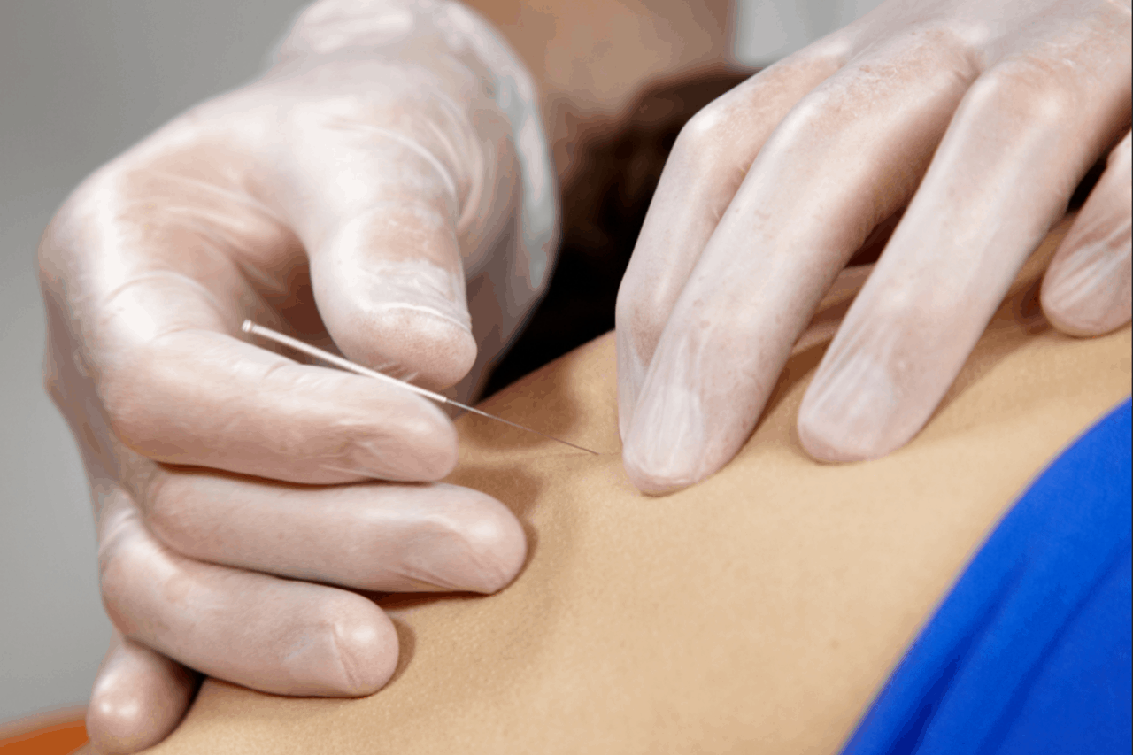 About Us/How It Works Bentonville Dry Needling iAMPT Thats The Knot Physical Therapy - About Us/How It Works